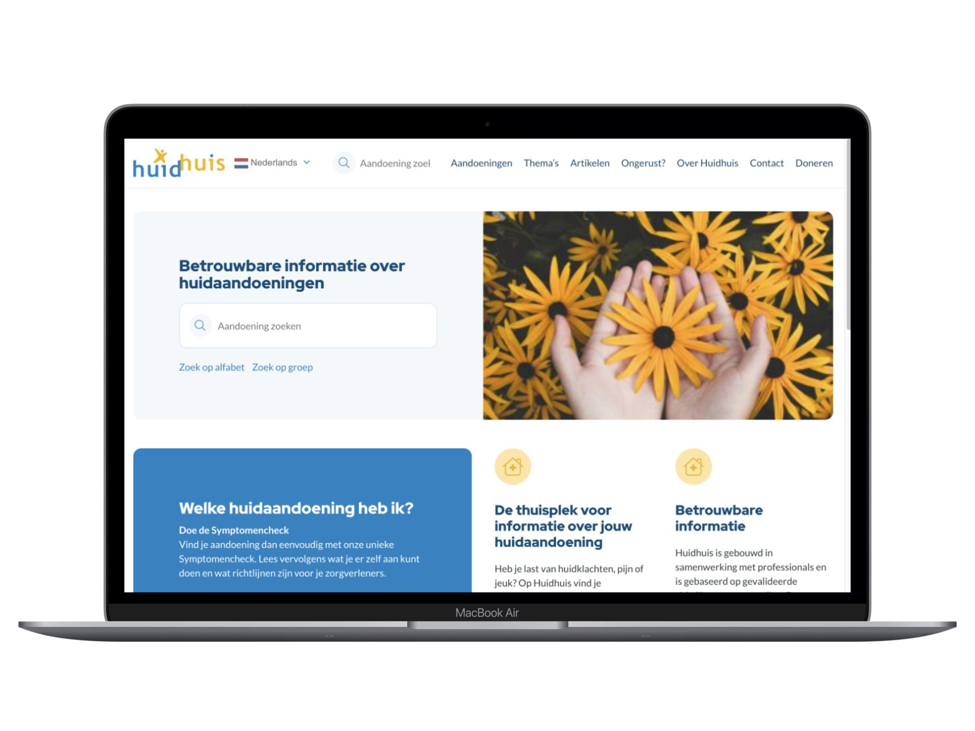 Huidhuis weergegeven op een laptop